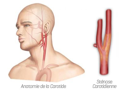 anatomie de la carotide