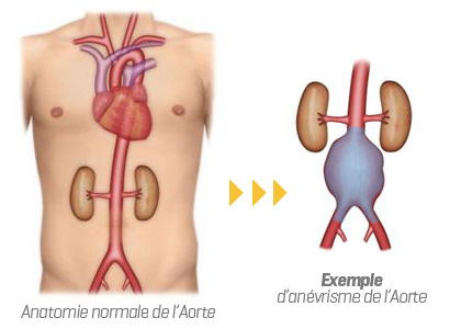anatomie de l'aorte
